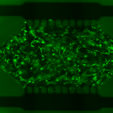 Gradient Confocal