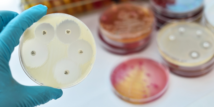 Antimicrobial susceptibility testing in Petri dish.