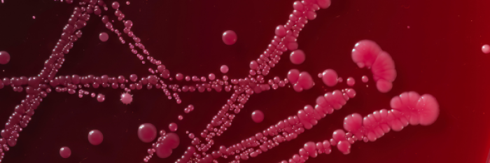 Fortschritte in der Diagnostik und Überwachung von Clostridioides difficile in der klinischen Mikrobiologie