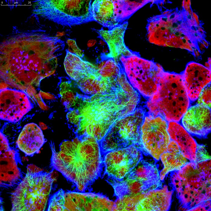 Hypoxia and Cancer Metabolism