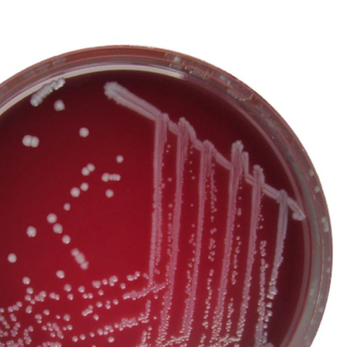 DYK7: Anaerobic Control Strains